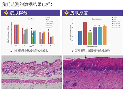 BOBSport建立的特应性皮炎及湿疹模型监测数据结果