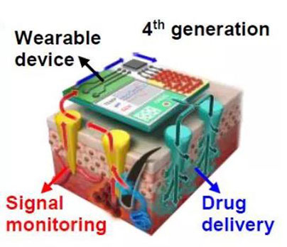 第四代透皮给药技术：在可穿戴设备的帮助下，用于患者定制治疗.jpg