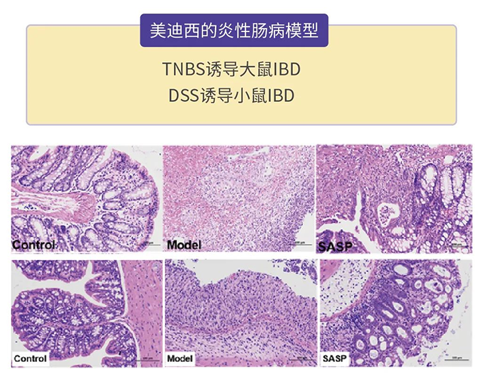 BOBSport的炎性肠病模型.png